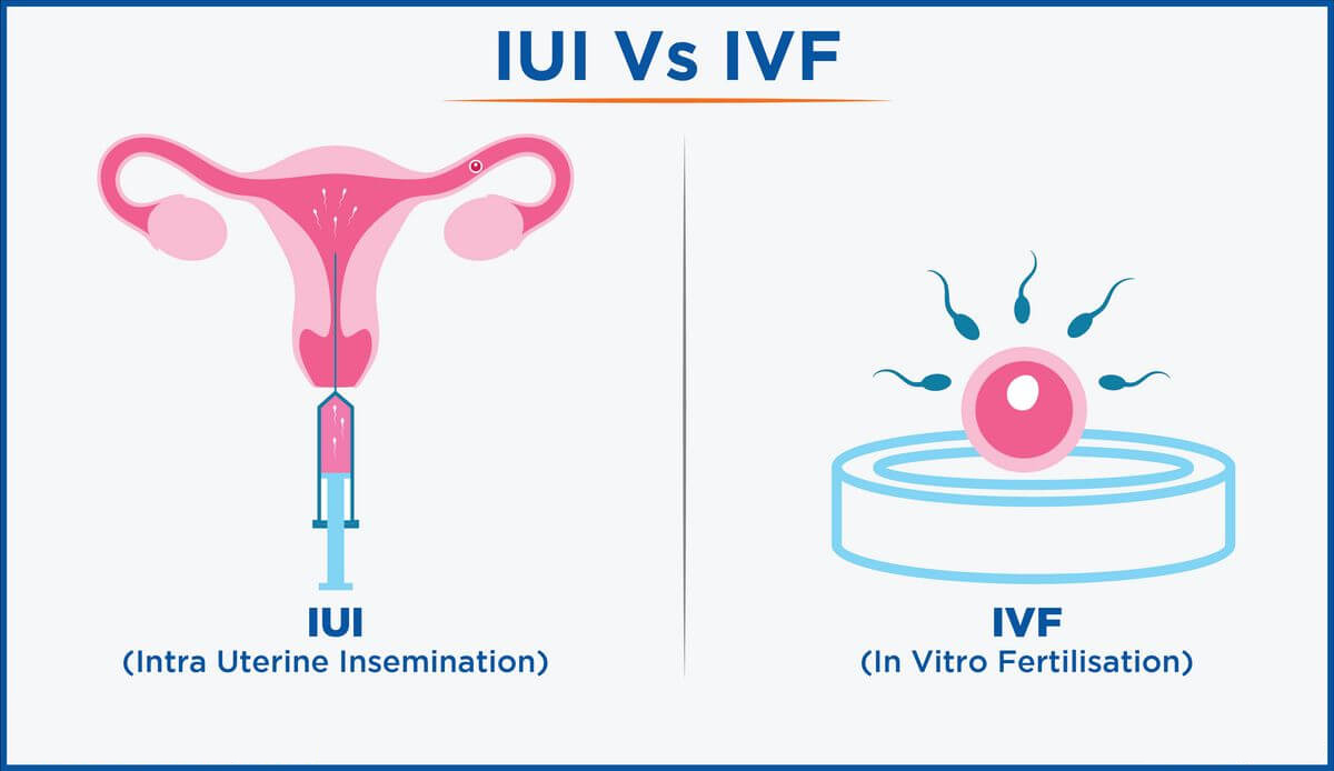 difference between iui and ivf